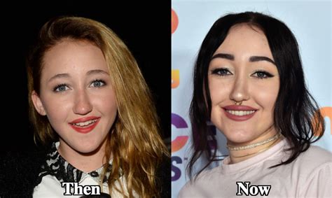 noah cyrus plastic surgery|We Cant Stop Staring At Noah Cyrus Transformation